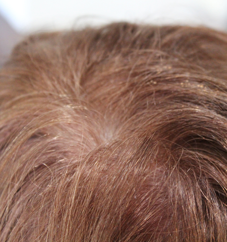 白髪１００％のヘアピースの写真6